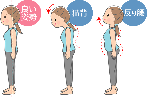 良い姿勢・猫背・反り腰のイラスト